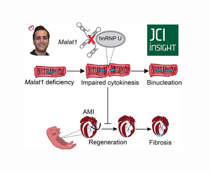 Malat1 deficiency prevents neonatal heart regeneration