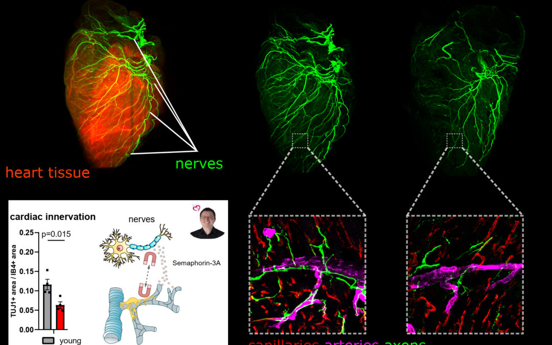 When the heart loses its nerve: New findings on the interaction of nerves and hearts during aging