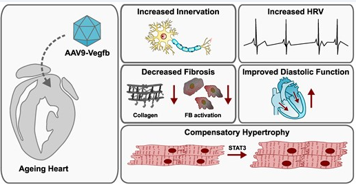 Beneficial effects of vascular endothelial growth factor B gene transfer in the aged heart